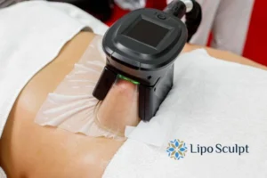 Cryolipolysis Helping You Getting that Perfect Summer Body 3 Cryolipolysis Bracknell can give you the best summer body - contact us today!