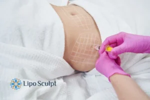 Are The Results From Aqualyx Permanent? 1 Do you want to know how long Aqualyx Bracknell results last?