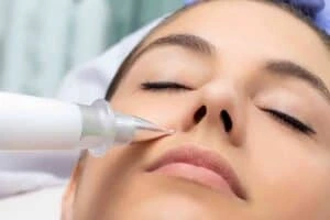 Best Actinic Keratoses Removal 3 Actinic keratoses Bracknell solutions - book in today!