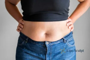 Bidding Farewell to Muffin Tops with Aqualyx Fat Injections 2 Do you wish you could reduce your muffin top Bracknell With Aqualy fat dissolving injections you can!